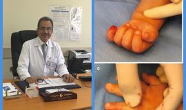 *وجه رسائل تثقيفية للأهل..د.صبري زيادة استشاري جراحة العظام بمستشفيات الحمادي:*  *إصابات أطراف الأصابع عند الأطفال شائعة..والتعامل الصحيح معها يعطي نتائج ممتازة*